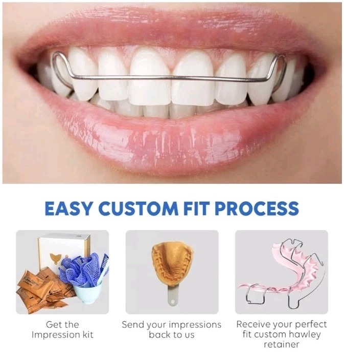 🦷 ⭐ Dental Impression Kit for Custom Retainers Upper & Lower Set