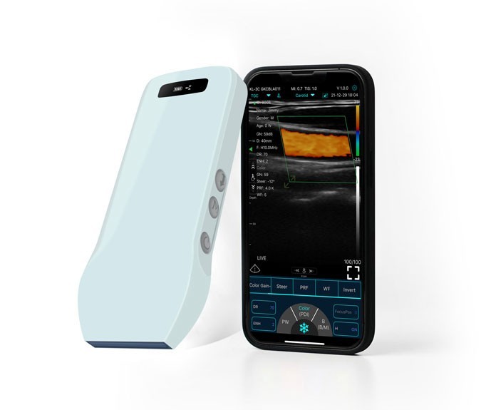 Portable Wireless Ultrasound Scanner - HD Linear Array Color Doppler