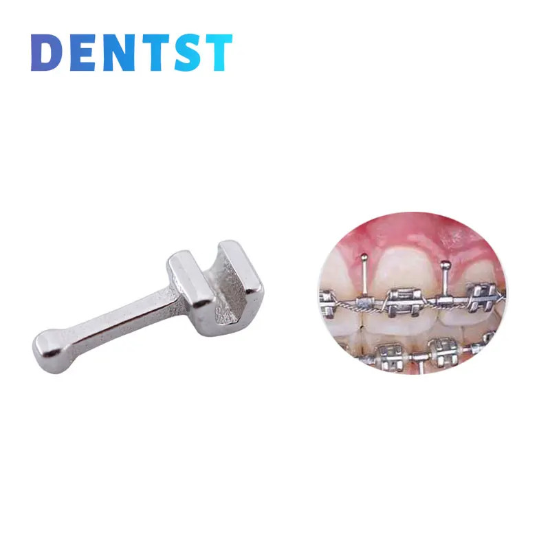 50Pcs Orthodontic Crimpable Lingual Button