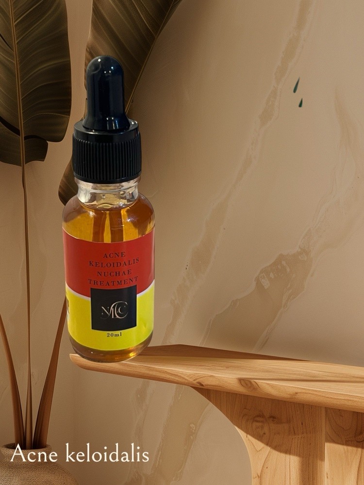 Acne Keloidalis Nuchae by NLC