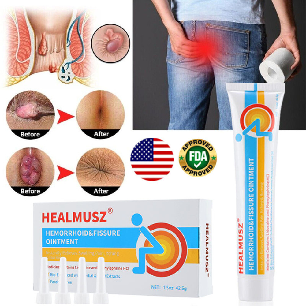 Hemorrhoids Remove Ointment Herbal Cream Relief Piles Pain Reduce Itching 42.5g