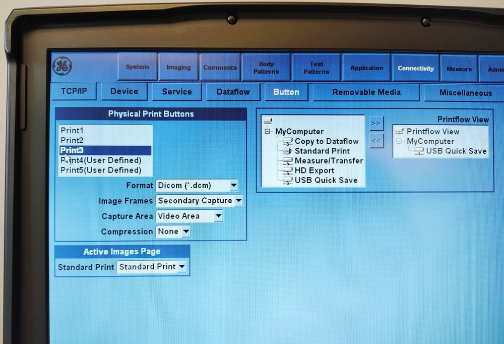 GE LOGIQ E Ultrasound System