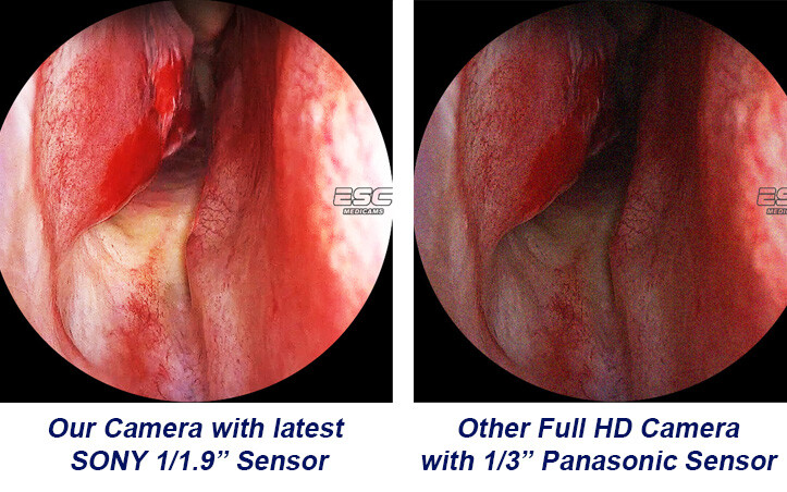 Endoscopy Camera Full Hd Laparoscopic Endoscope ENT 1080p Medical Storz Olympus