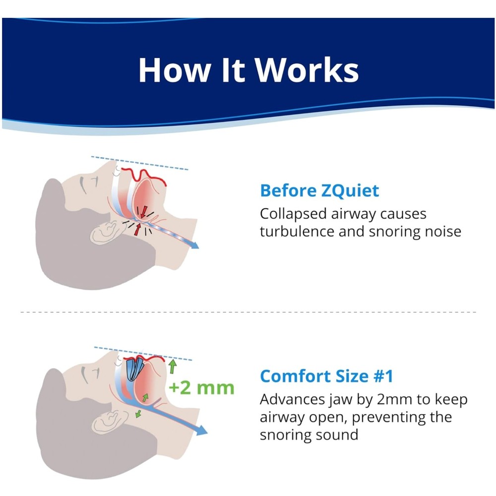 Anti-Snoring Mouthpiece Single Refill