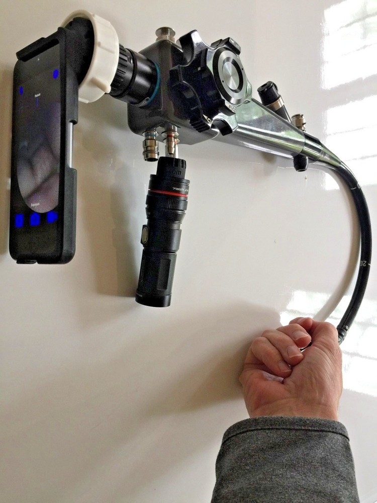 OLYMPUS Flexible Gastroscope 34cm long with light and iPhone adaptor
