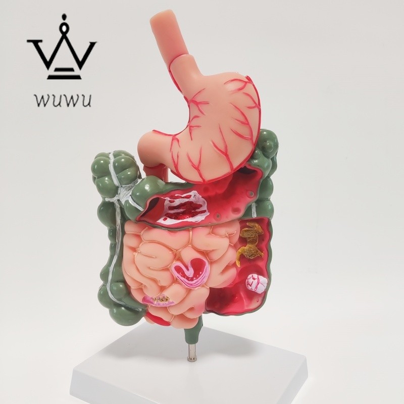 Removerable Human Stomach Anatomy Model Pathological Digestive System Model