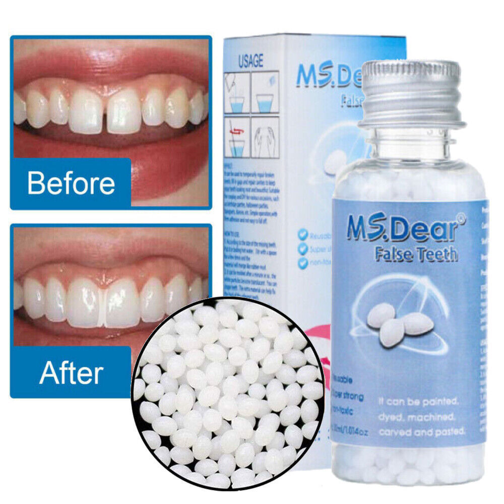 Tooth Repair Kit Temporary Teeth Replacement Beads for Missing & Broken Teeth