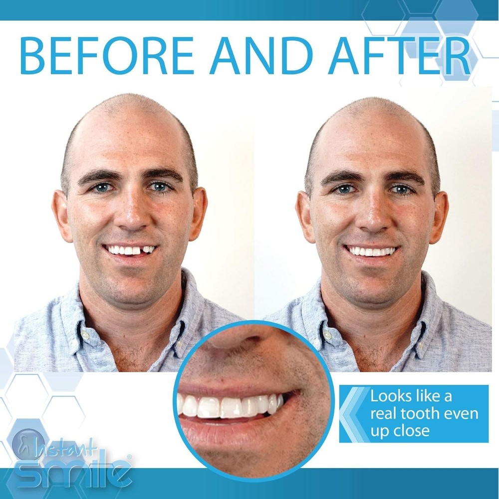 Complete Your Smile Temporary Tooth Replacement Kit - Fast & Realistic Solution