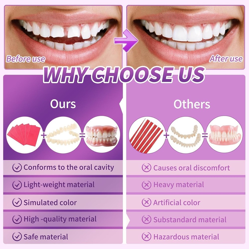 DIY Denture Kit for Upper & Lower False Teeth - Custom Dental Impression Kit