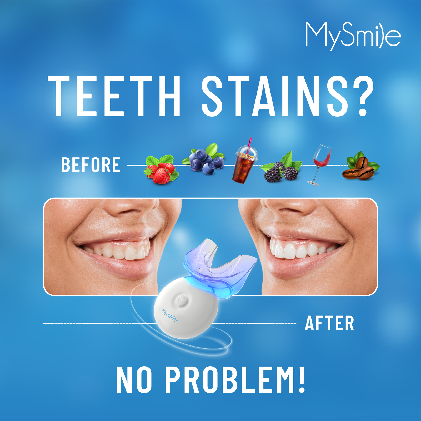 MySmile PAP Teeth Whitening Kit with 5LED Light Upper Lower Tray Whitener Gel