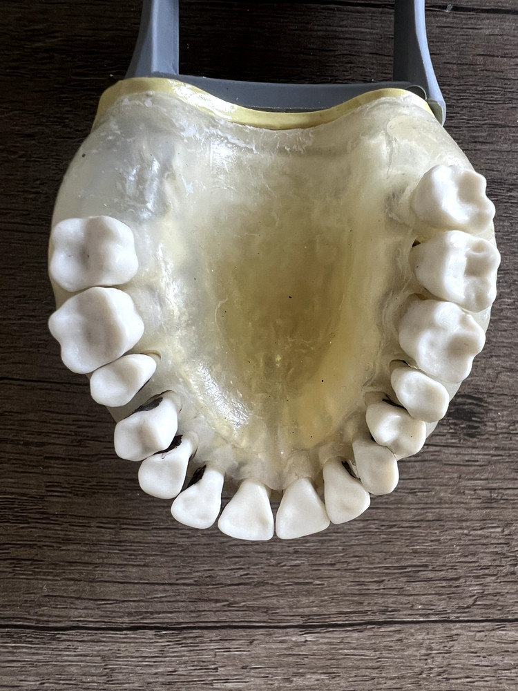 Nissin Periodontal Typodont Includes Both Upper And Lower Arch