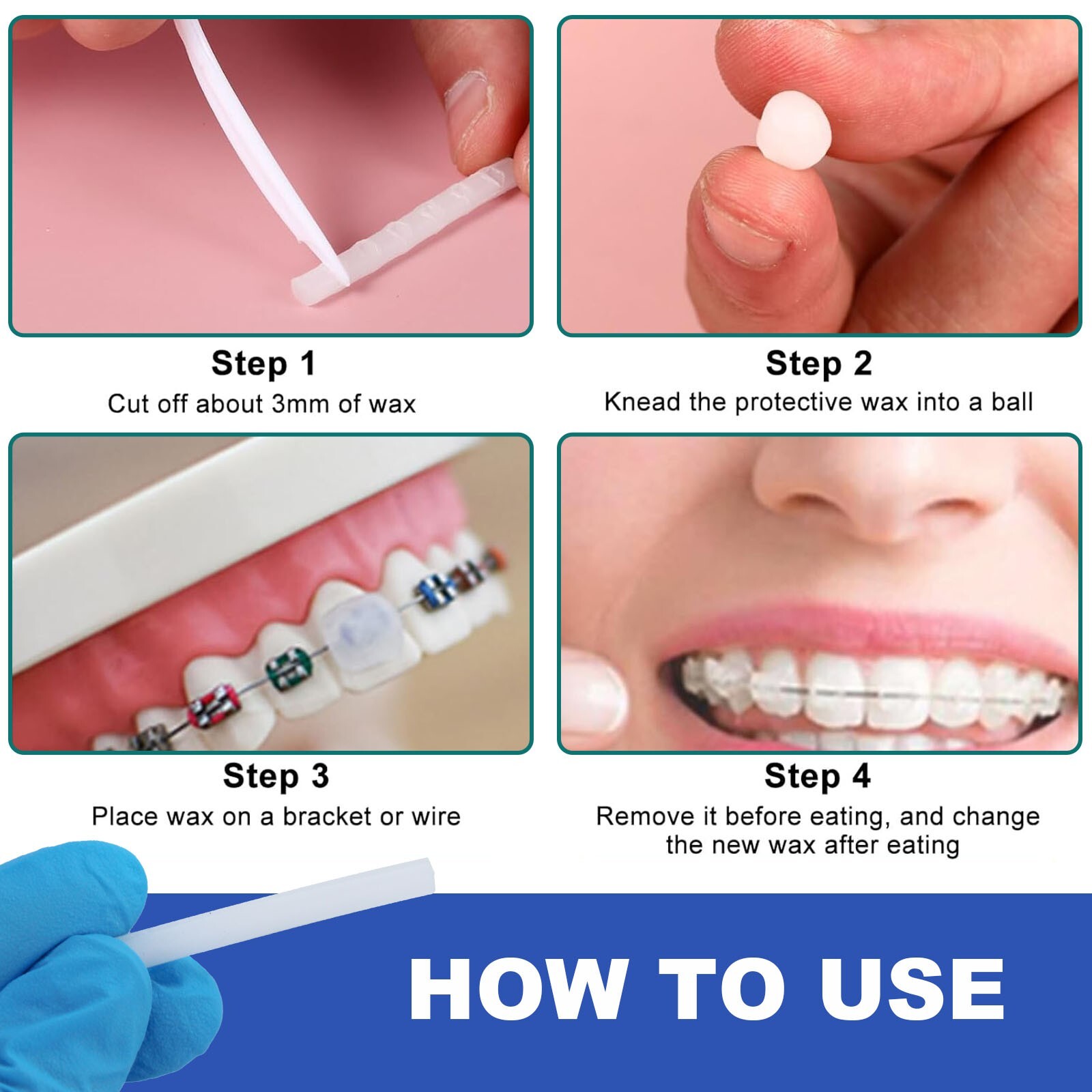 Dental Grade Orthodontic Wax for Braces & Aligners by JEVOLVE