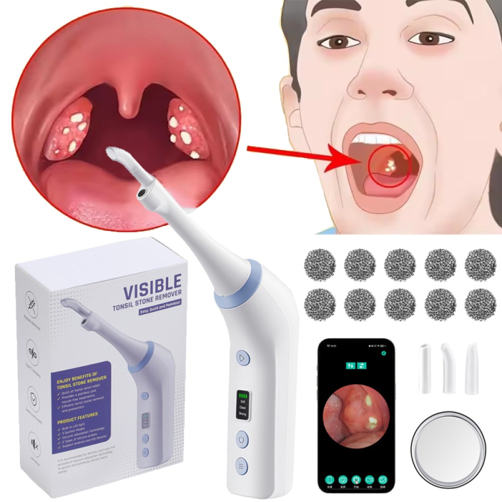 Electric Visual Tonsil Stone Remover Kit LED Light Vacuum Tonsil Stone Cleaner