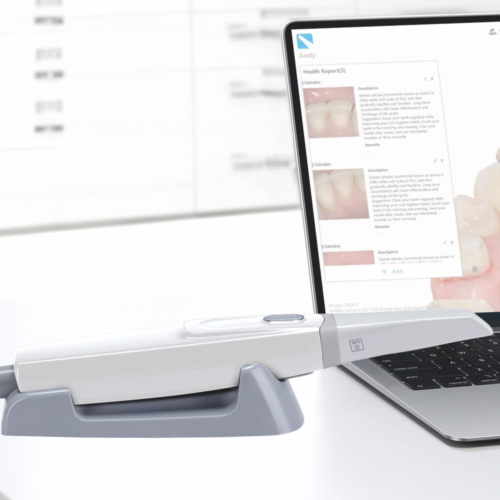 Dental Intraoral Scanner 3D Real-time Display With Scanning Software