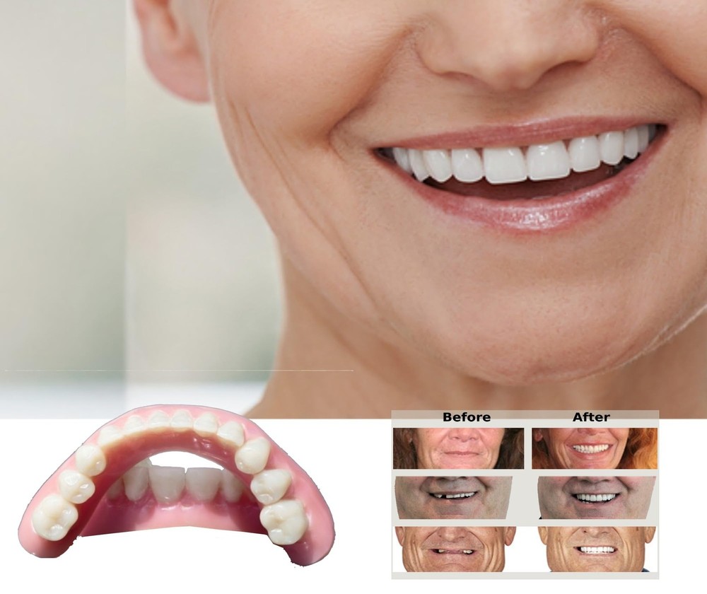 DIY Denture Kit with Impression(2 Sets of False Teeth),Do-It-Yourself Denture...