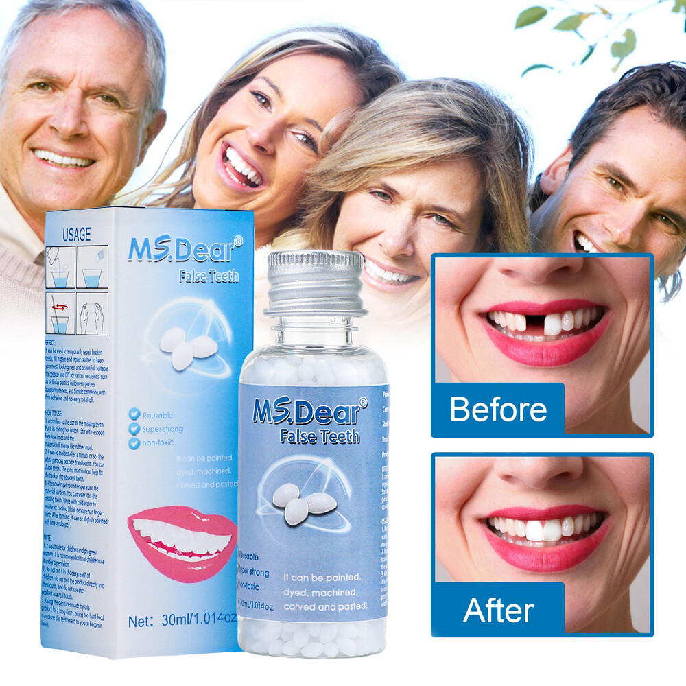 Tooth Repair Granules Temporary Kit Moldable False Teeth Fitting Beads Reusable