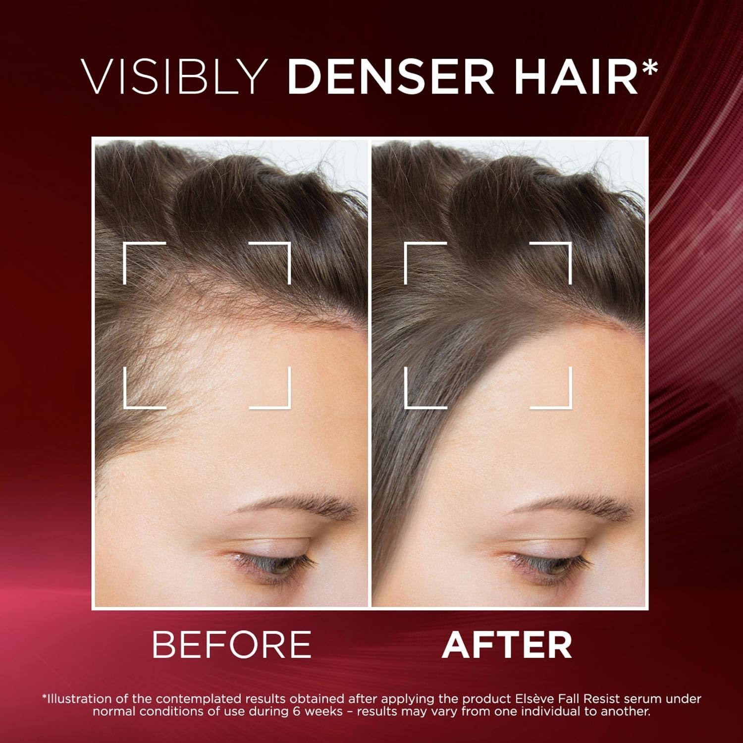 L'Oréal Fall Resist Serum 102ml with Aminexil, reduces hair fall I FREE SHIPPING