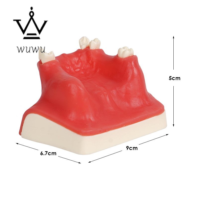 Dental Implant Teaching Model Upper Jaw Maxillary Sinus Model