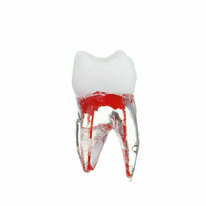 Dental Tooth Endo Root Canal Study Model For RCT Practice Blocks Pulp Cavity
