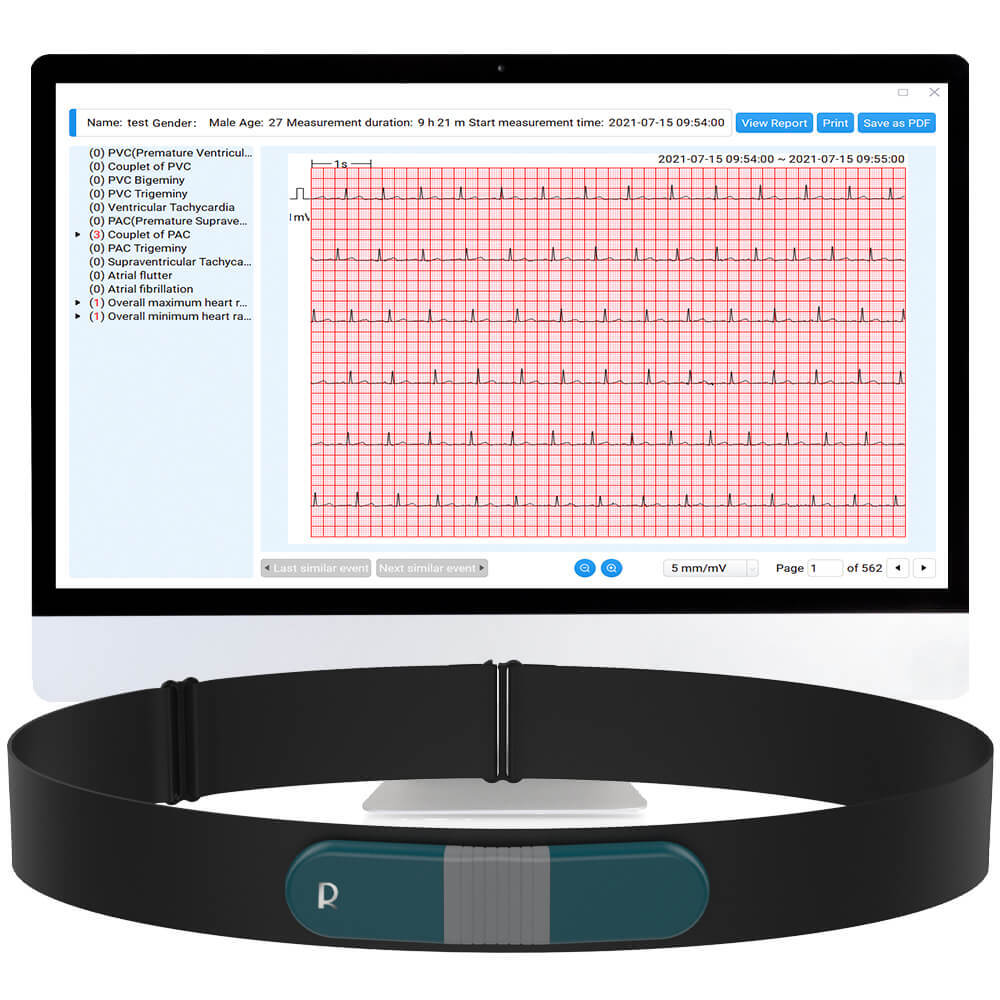 Holter Monitor 24 hours EKG Monitor ECG Recording PC Software Free AI Analysis