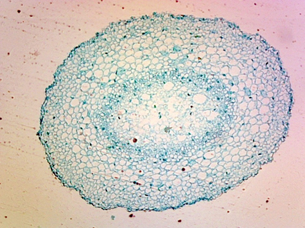 Lilium Root Tip; Typical Monocot Root; Cross Section