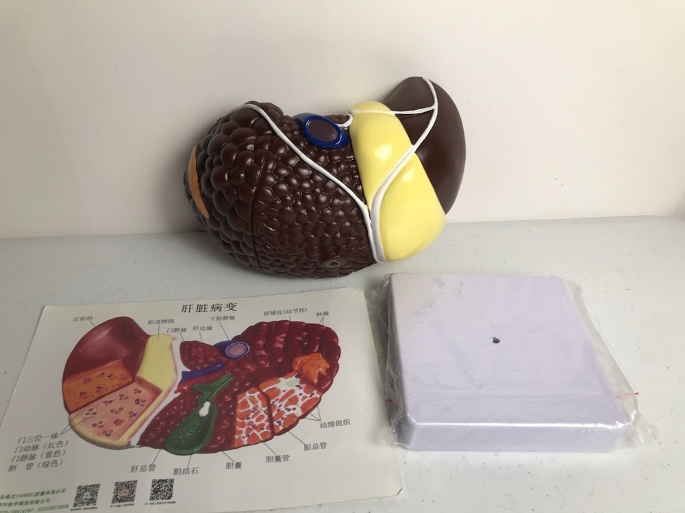 Pathological Liver Anatomical Model 1:1 Human Liver Model Anatomy Display Study