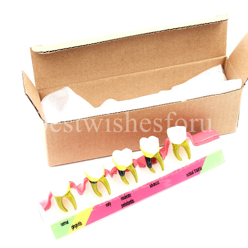 Dental Periodontal Disease Assort Developing Demonstration Teeth Study Model