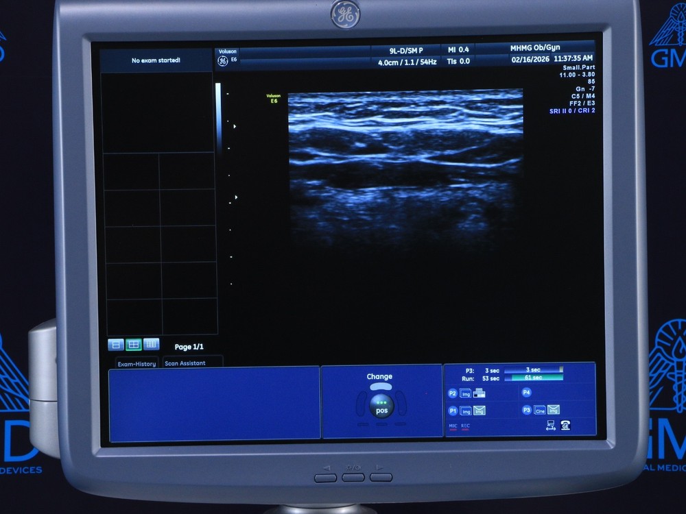 GE 9L-D Linear Array Transducer