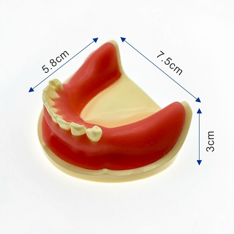 Teeth Model Implant Practice For incision drilling Practices Dental Study Model