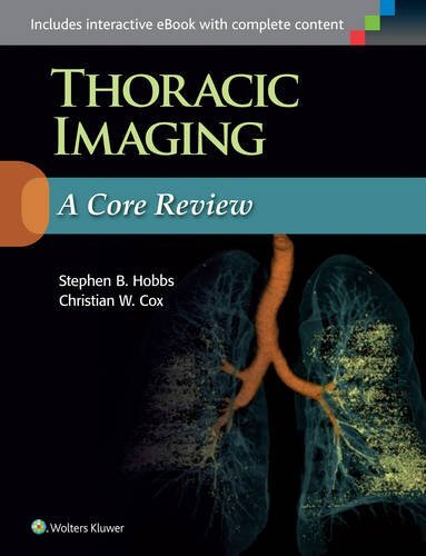 Thoracic Imaging by Stephen Hobbs