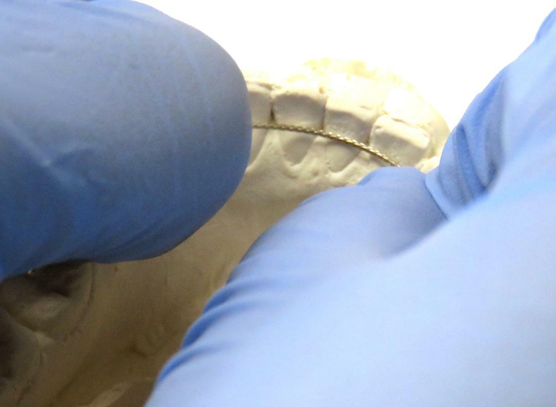 Dead Soft Flat Ortho Lingual Retainer Wire - 60" - Spool/ Roll/ Strips