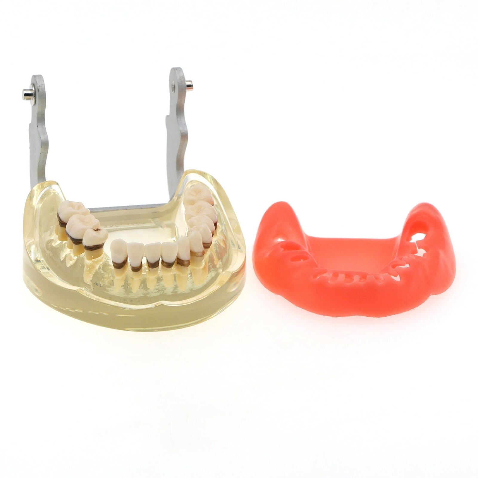 Dental Adult Periodontal Disease Pathological Teeth Typodont Model Removable Gum