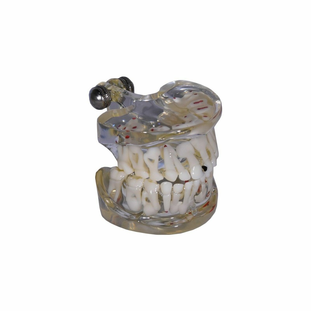 Redland Model Dental Demonstration Teeth Educational Model -FDA