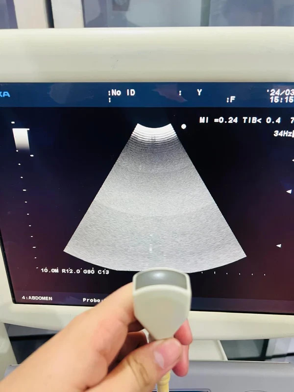 ..Aloka UST-987-7.5 Microconvex probe checked dxb