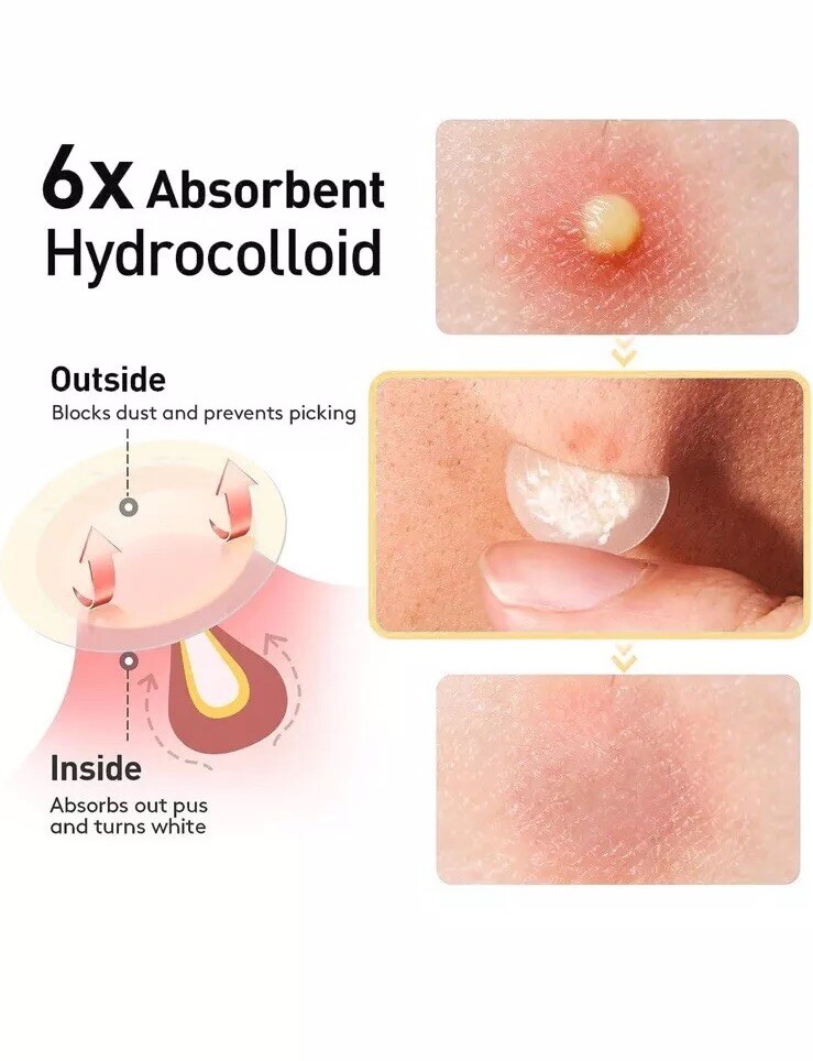 Silky Sense Beveled Acne Patches