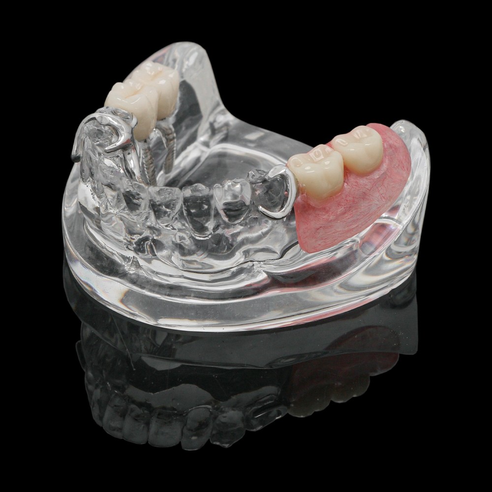 Dental Training Typodont Model with Removable Partial Denture Teaching Model