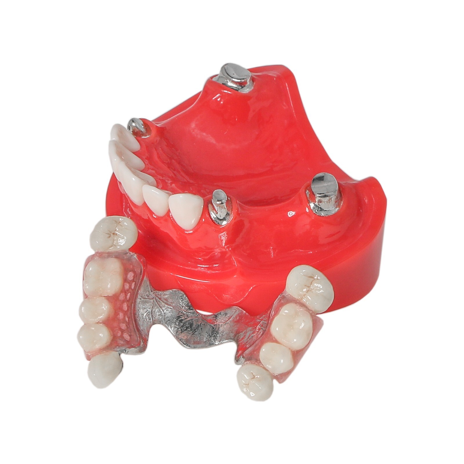 Dental Implant Typodont Teeth Restoration Model Series Overdenture Practice Demo