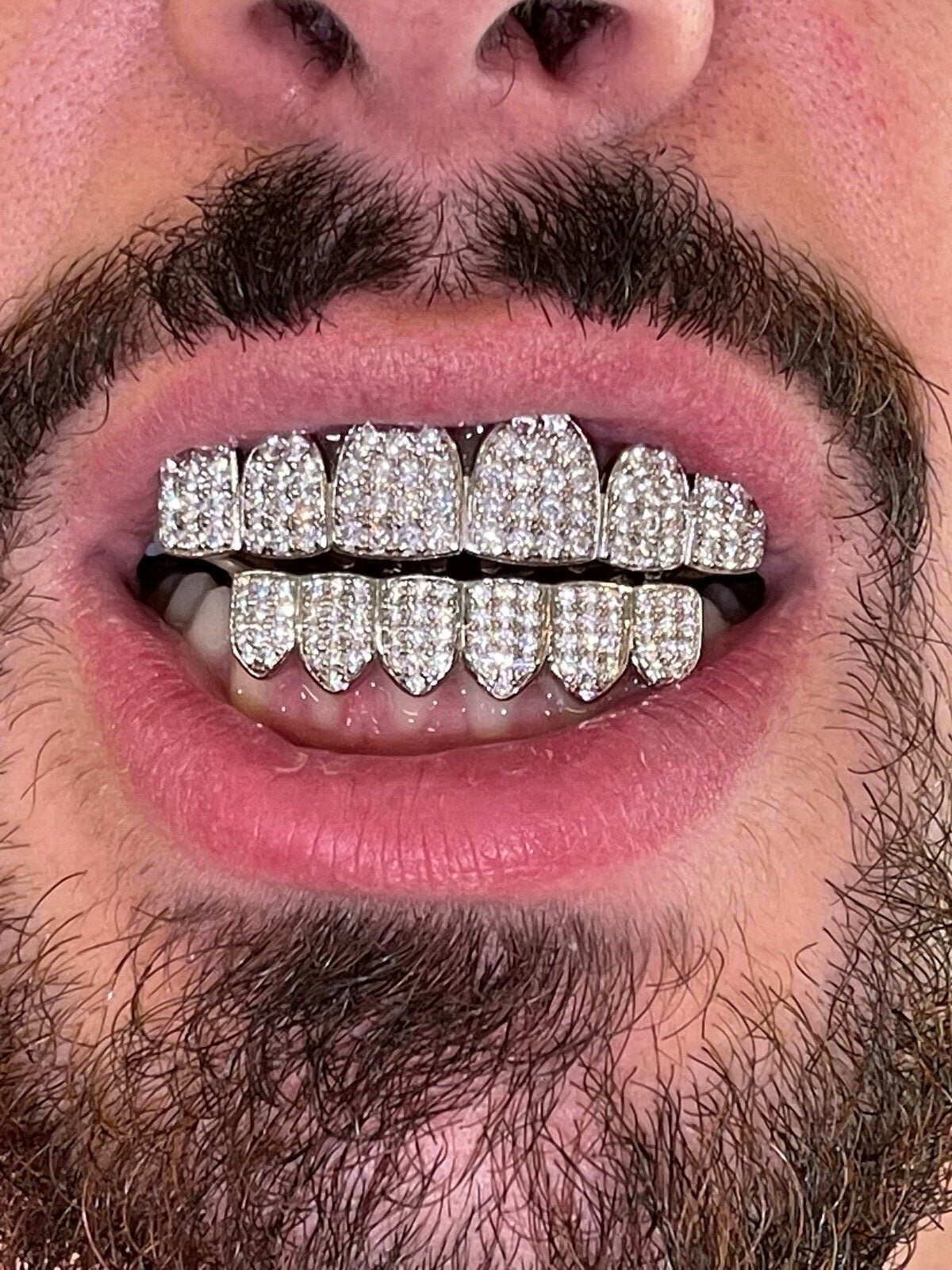 MOISSANITE GRILLZ Passes Test Teeth Top & Bottom Hip Hop 925 Silver Iced Rapper