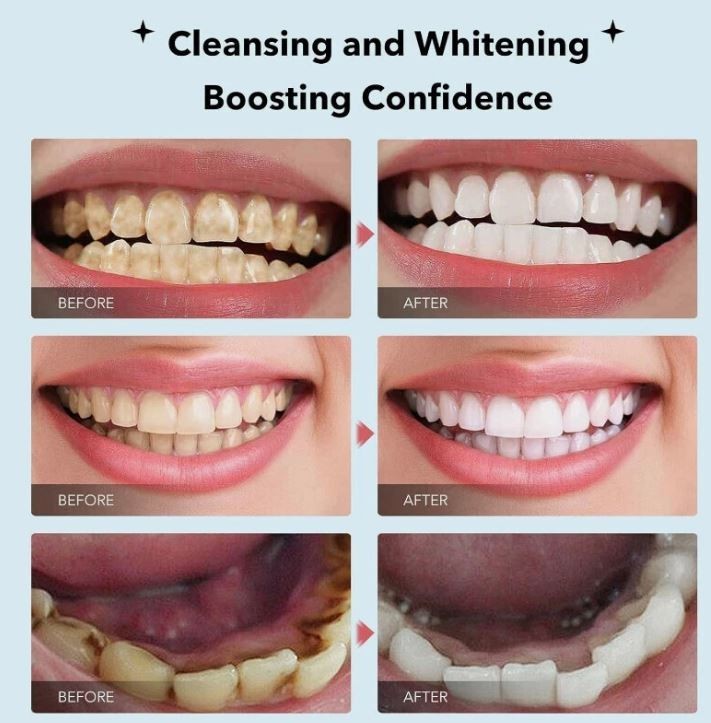 7.5% Nano Hydroxyapatite Toothpaste Remove Deep Clean For Sensitive Teeth