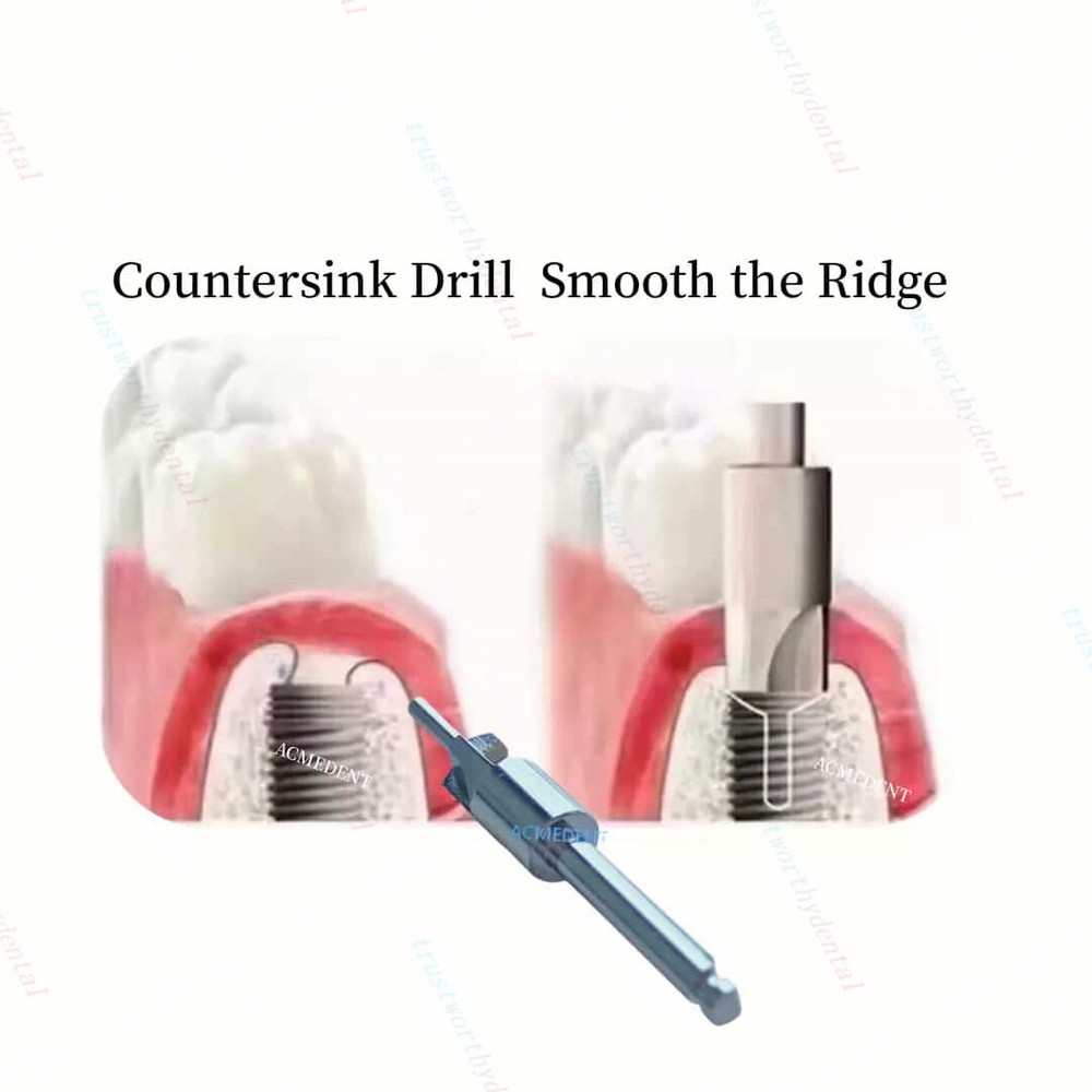 Dental Level Bone Profiler Remover Implant Shoulder Interfere Trimmer Drill