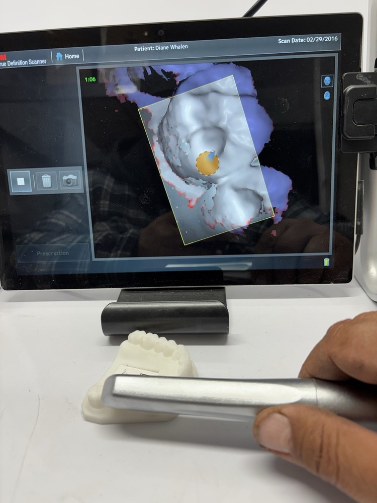 3M TRUE DEFINITION INTRAORAL SCANNER