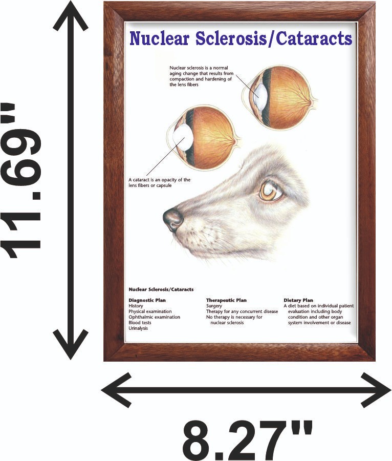 Nuclear Sclerosis/Cataracts Chart 12x18 inches