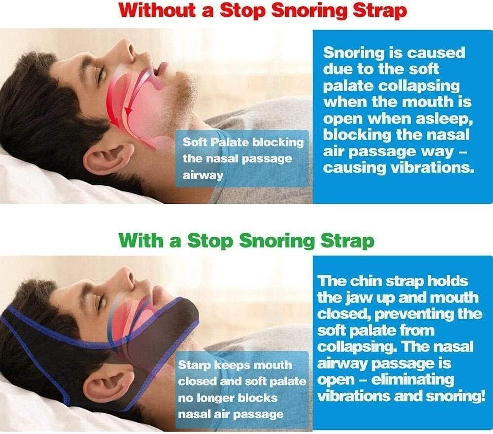 Universal Snoring Devices Adjustable, Chin Strap, Sleep Apnea, Jaw Solution