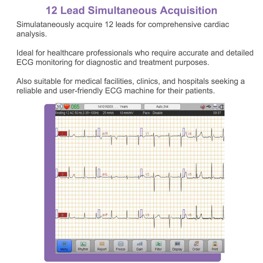 Biocare iE6 12 lead 6 channel ECG Machine Touchscreen with interpretation FDA US