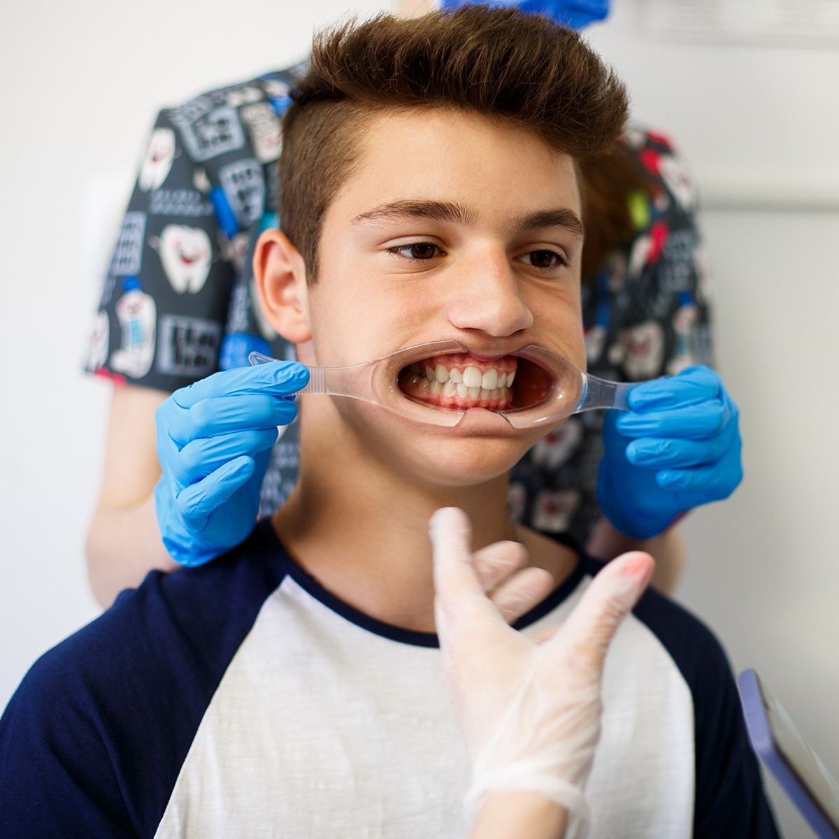 10Pcs Dental Transparent Mouth Opener Lip Cheek Retractor Mouth Spreader