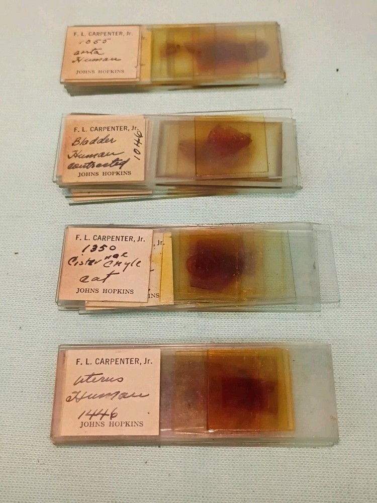 Vtg 1925 Ernst Leitz Wetzlar Microscope both Binocular & Single & Case & Optics