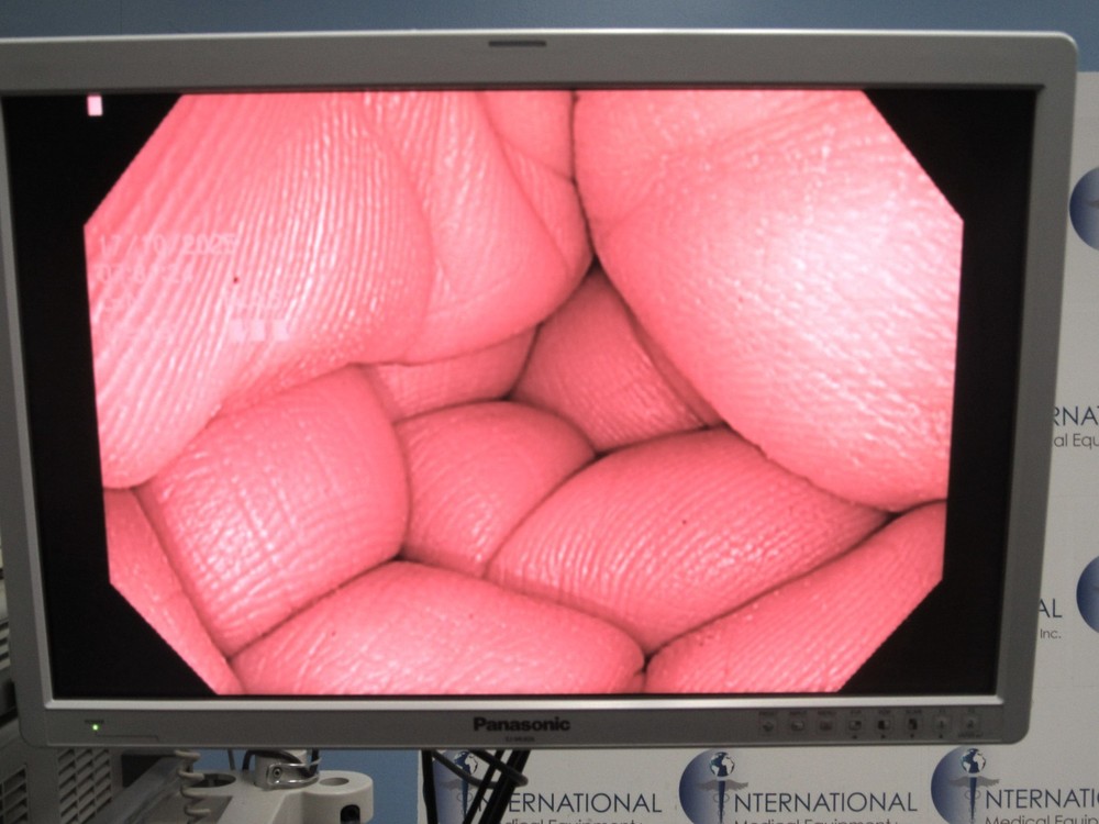 Olympus PCF-H180AL Colonoscope Endoscopy Endoscope #1