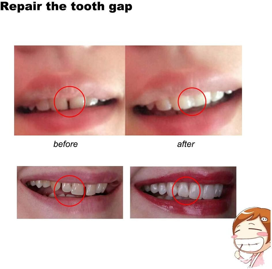 3 Colors Temporary Moldable False Teeth Repair Replacement Thermal Fitting Bea..