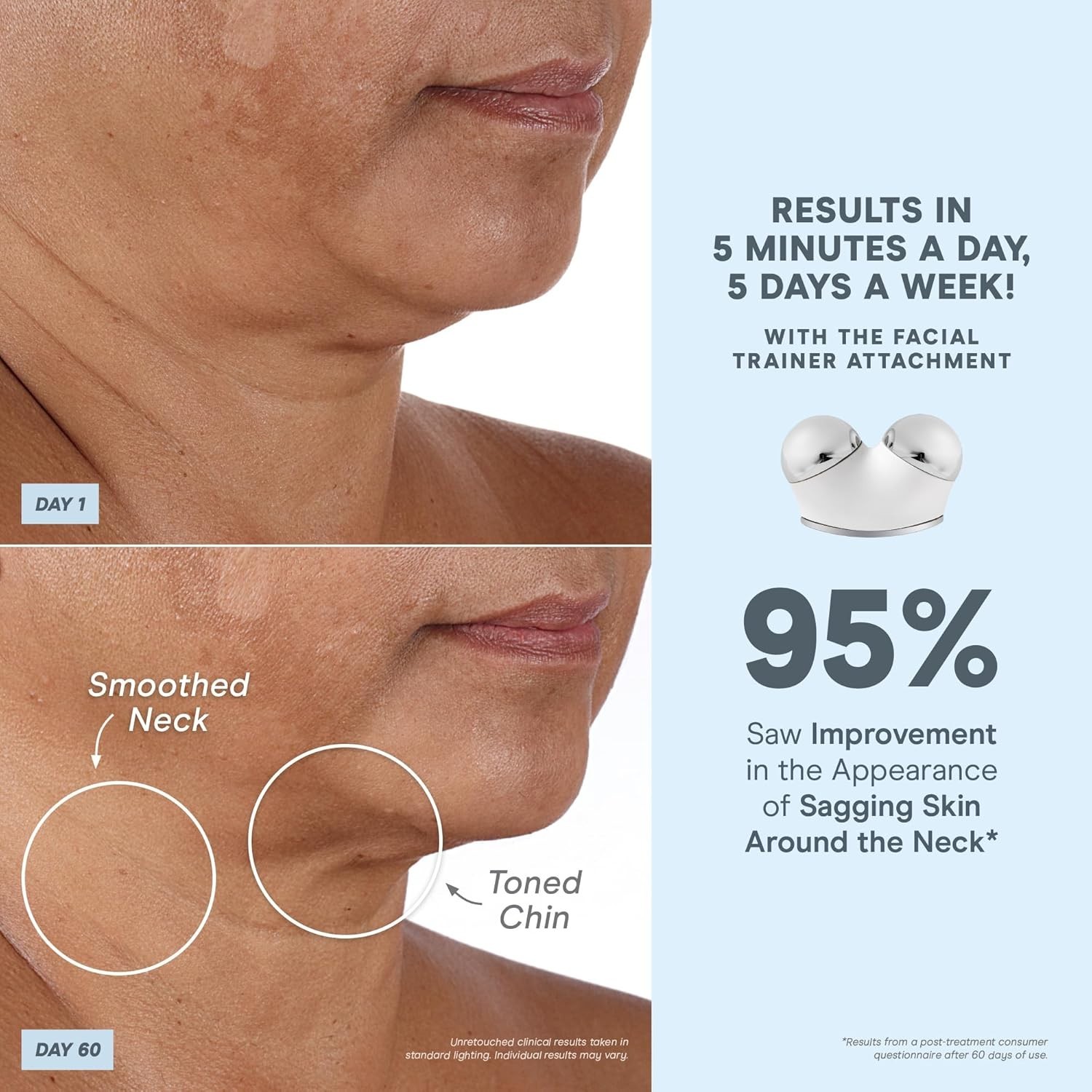 NuFACE Trinity+ Microcurrent Facial Device Kit - FDA Cleared Face Sculpting & Ne