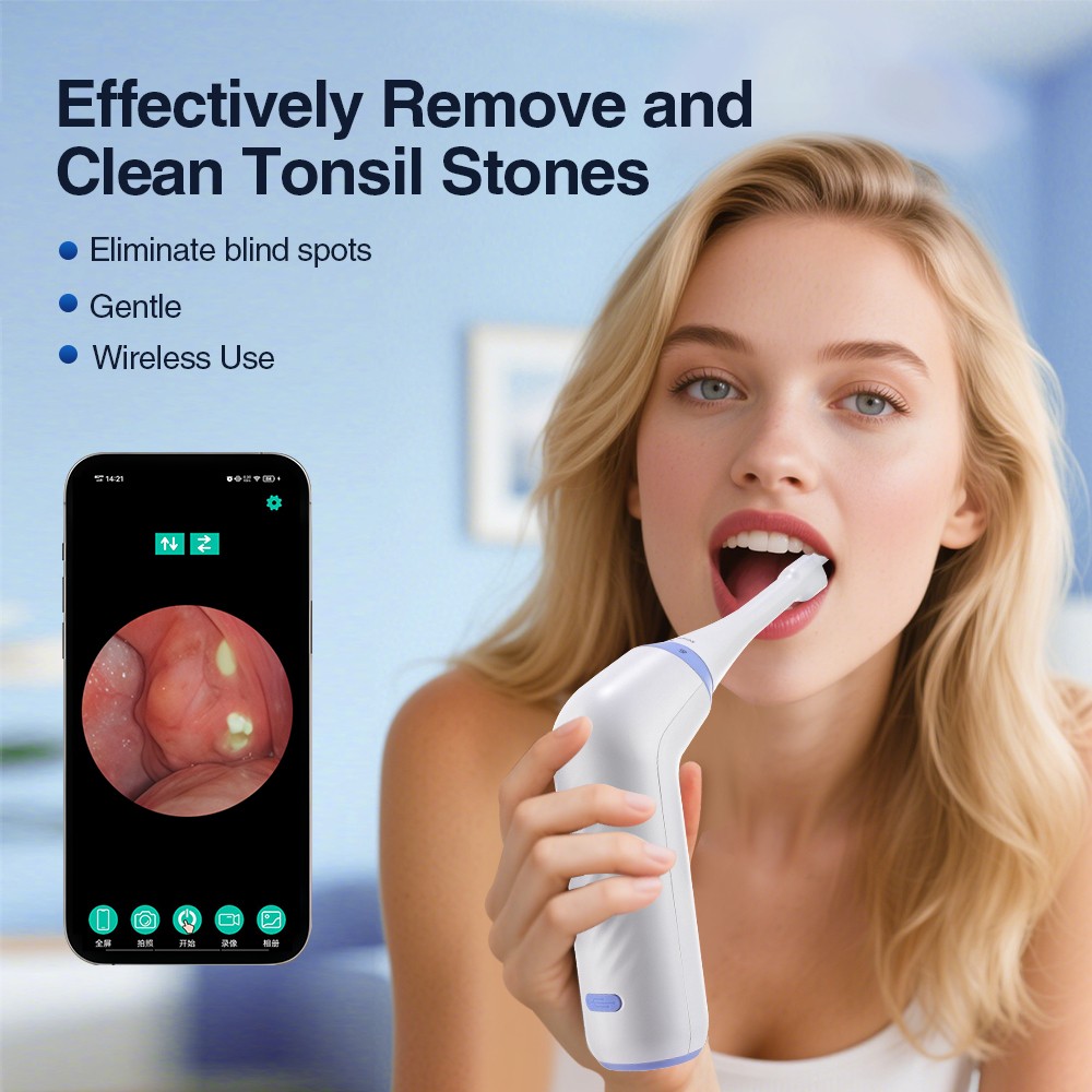 Electronic Tonsil Stone Remover Kit with LED Light & 3 Adjustable Suction Modes